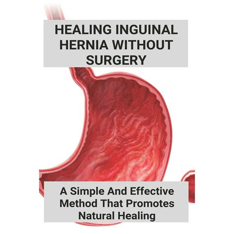healing inguinal hernia without surgery